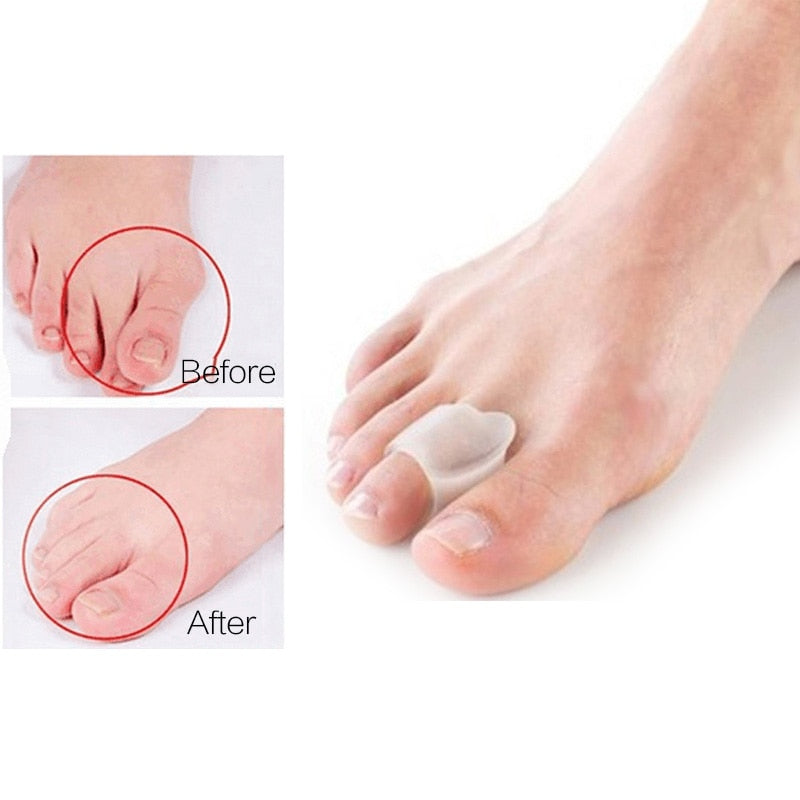 Séparateur d'orteils en silicone | Correcteur Hallux Valgus
