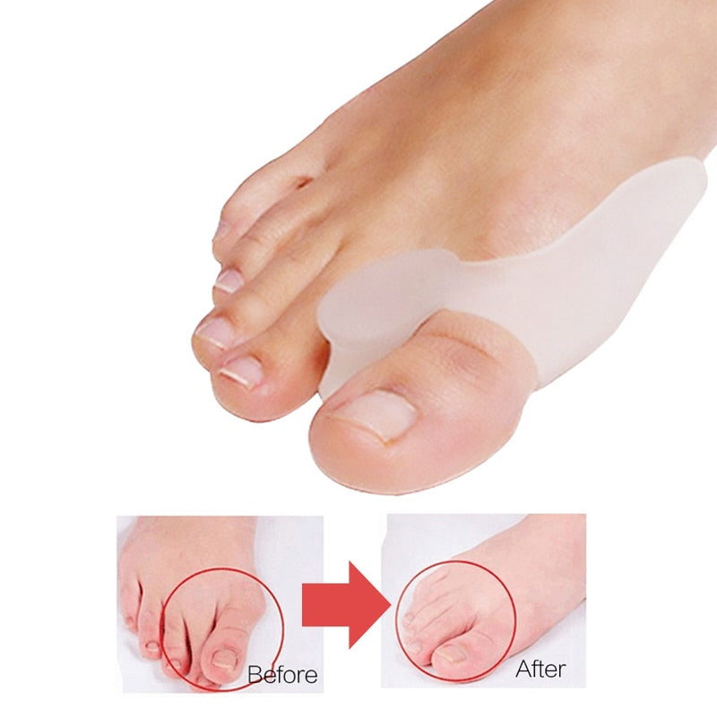 Séparateur d'orteils en silicone | Correcteur Hallux Valgus