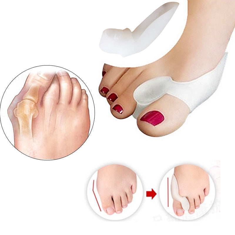 Séparateur d'orteils en silicone | Correcteur Hallux Valgus